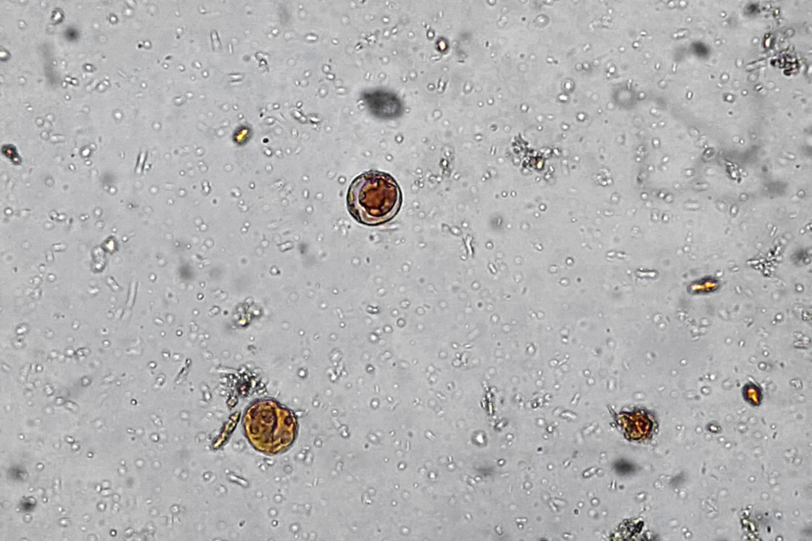 Parásito Blastocystis hominis al microscopio