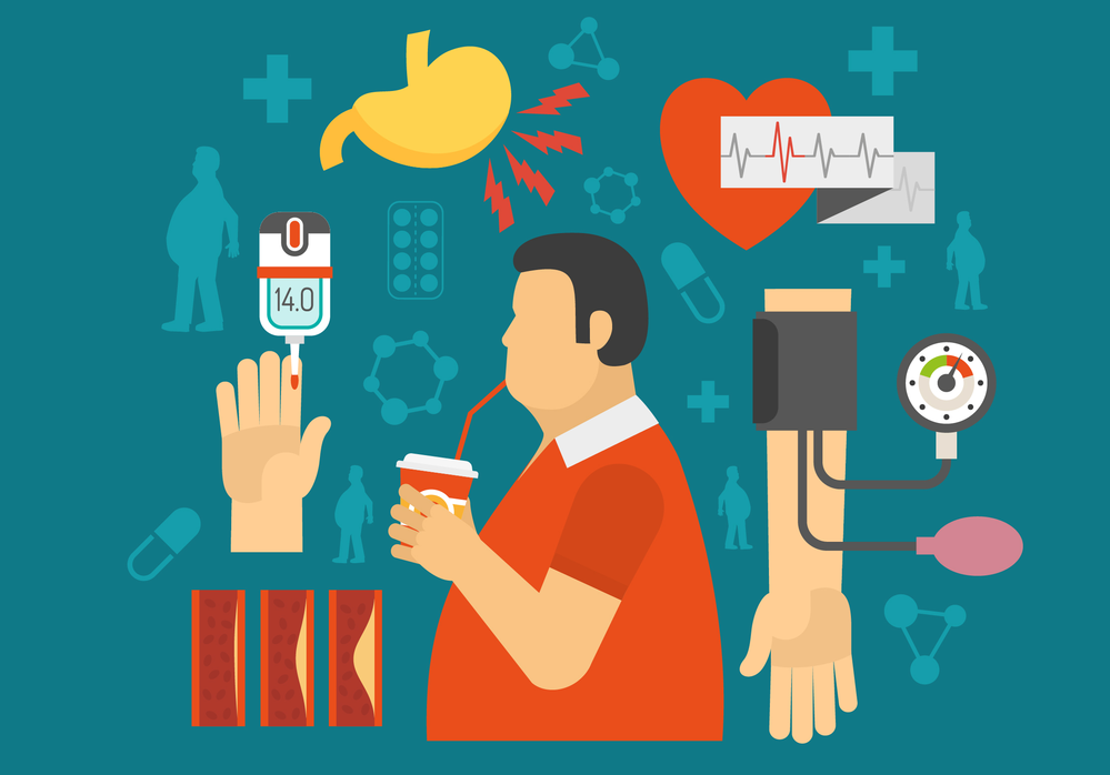 Ilustración de diabetes mellitus